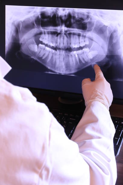 Best Emergency Tooth Extraction in Woodbury Center, CT