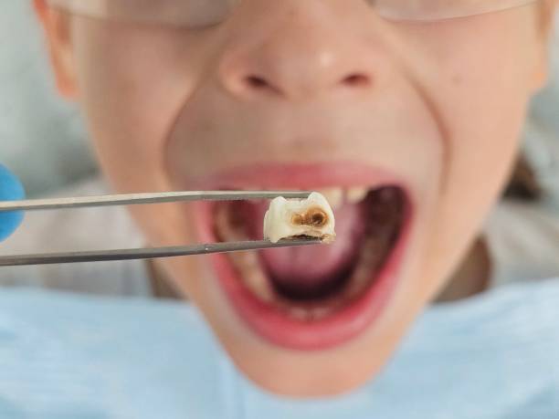 Best Emergency Gum Treatment in Woodbury Center, CT